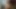 2021.cum complication