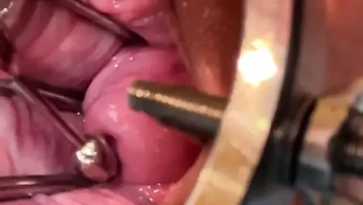 Exploring My Cervix With Sound And Fingers