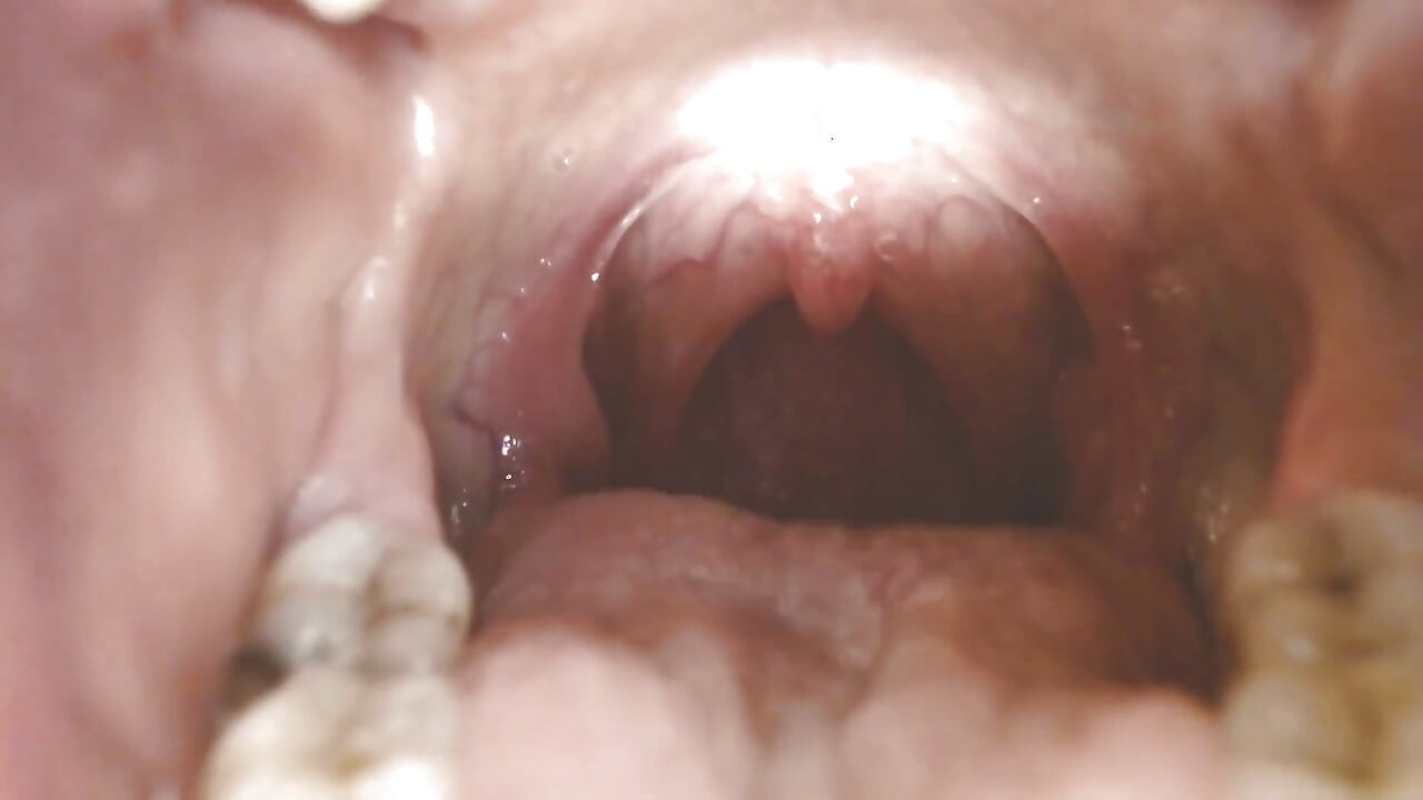 喉咙和嘴巴吐绳Uvula扁桃体Uvula