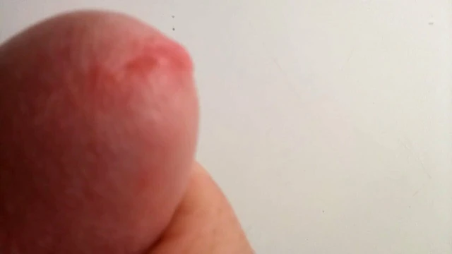 Dick