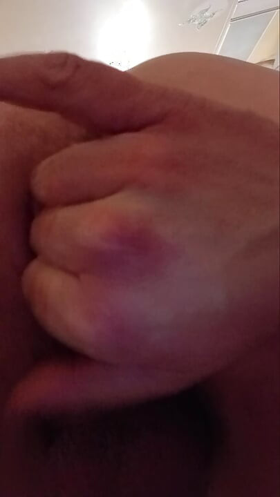 Fingering prolapse