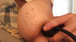 Pregled videozapisa