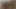 LizzyYum december 20 2023 Post Op Orgasm Pussy Masturbation Teasing
