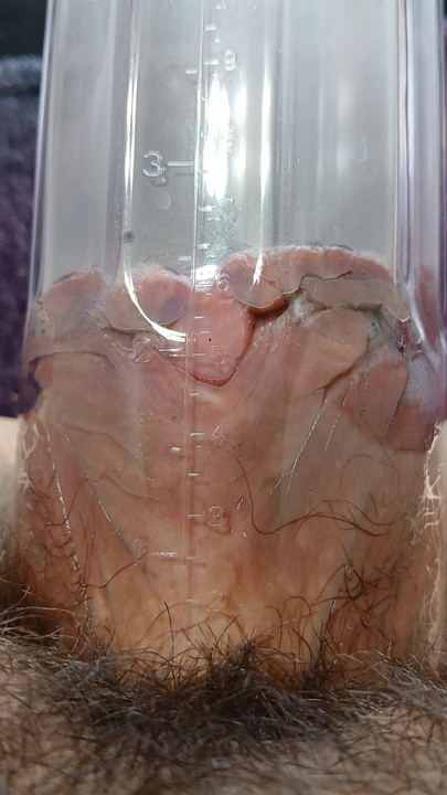 Lunaxscorpia punci pumpálása | Klip 1