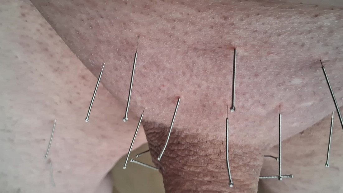 Needles