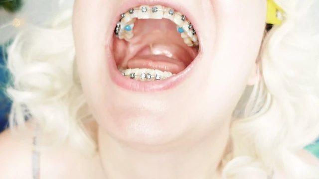 braces fetish: close up video mukbang