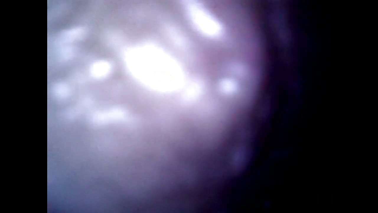 Endoscope Details - Hole Balls Cock Foreskin Belly Nipples Mouth Sperm