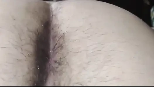 An Extreme Close-up of a Super Hairy Butt. I Haven't Cleaned Myself up Very Well, It Seems