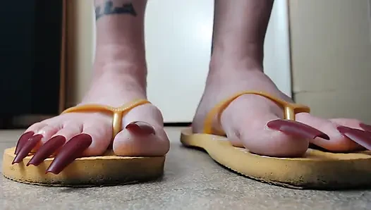 Toenails hanging off yellow flip flops