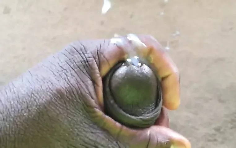 Sexual chocolate eruption