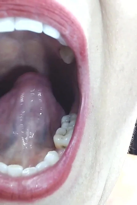 Inside My Big Mouth Tongue Teeth Uvula