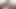 Latina-Porno ohne Scham !! Patientin will das Rehabilitationszentrum verlassen und tanzt zum Arzt