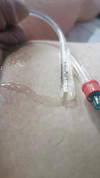 Pregled videozapisa