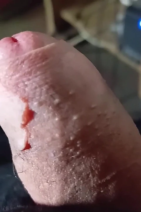Ja masturbiram više od 20 minuta