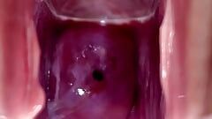 Cervix palpitante e che scorre sborra cola durante il gioco con lo speculum da vicino