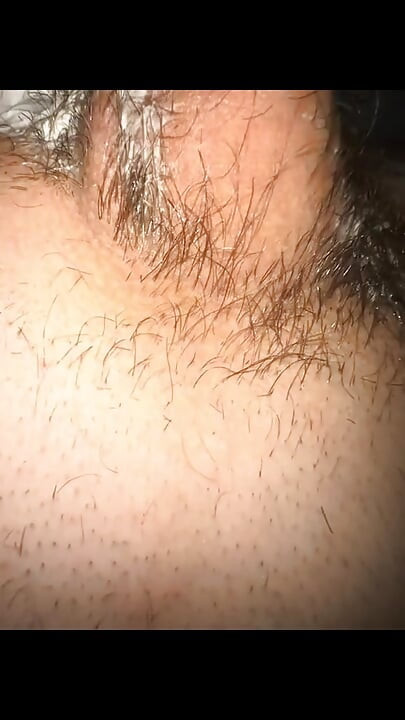 I was shaved completely