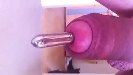 Dick üretral dilatör ile dolu