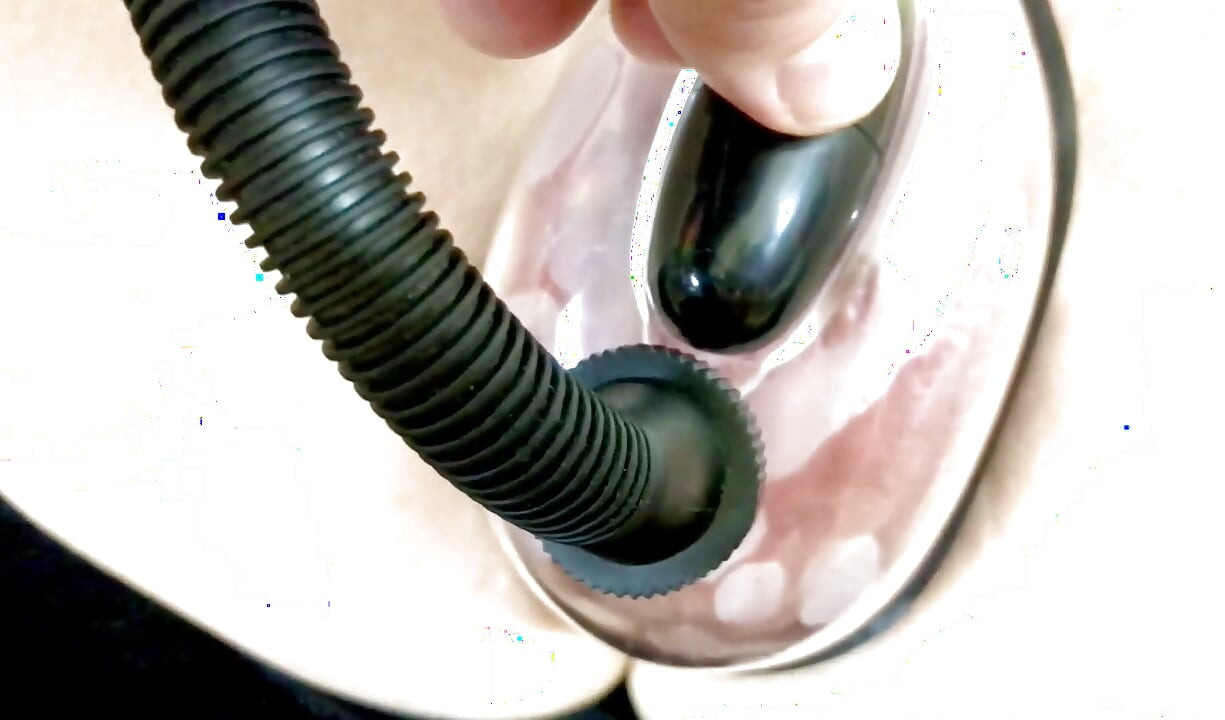 Vaginal Deformation Under the Influence of a Vacuum Pump