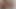 LizzyYum February 2024 daily #2 Post Op Orgasm anal masturbation Pussy teasing