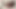 Only3x Presents - Zoey Balykina and Artie in 18+ Teens -
