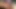dickpic