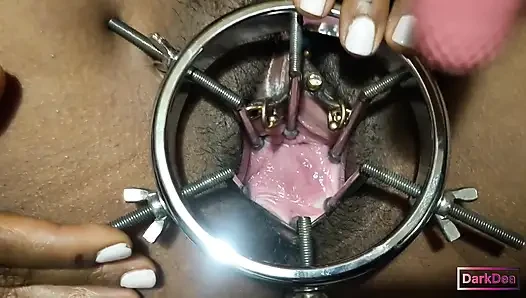 The kinky slut queen "Dark Dea" in (extreme cow speculum with final fist...