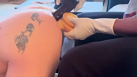 Ağrılı anal esneme