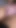 Spectacular moment from "Amateur In Stockings And Cute Panties Teases Her Teen Camel Toe"