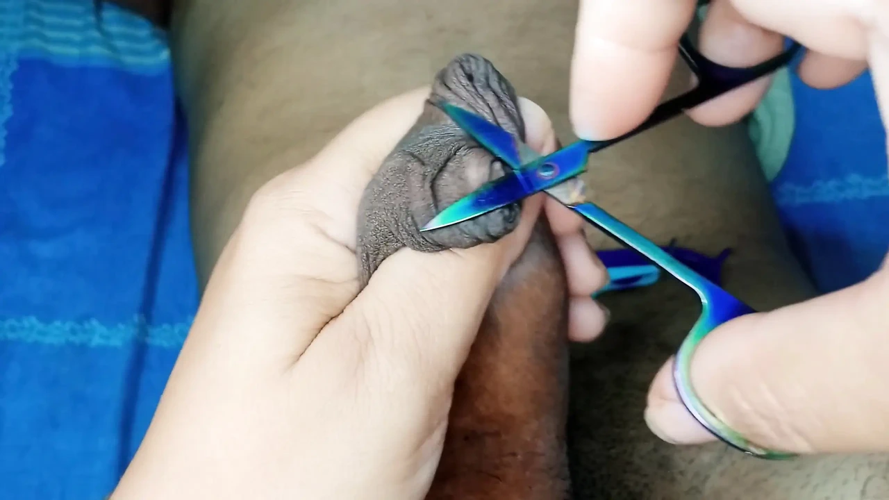 最好的包皮包皮环割角色扮演打手枪