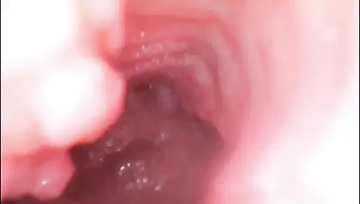 Endoscope Creampie. Cam Inside Pussy Shows Dick Cumming Inside Pussy