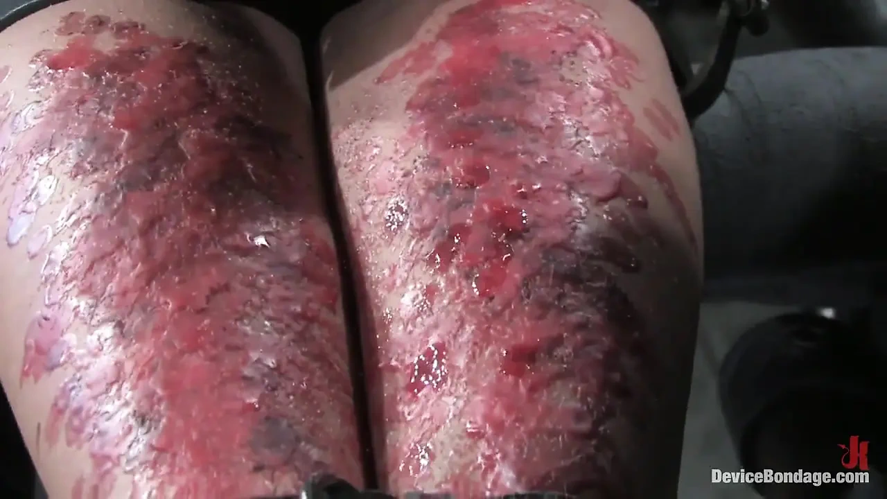 奖金更新：11月直播第2部分