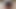 Hairy Asian big clit masturbation..Kyd!!!