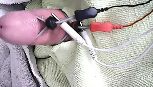 Estim sondaj mastürbasyon