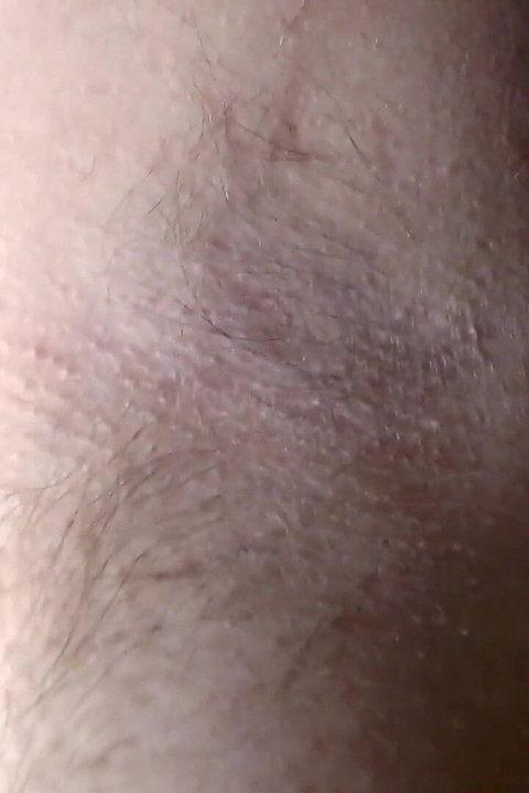 Closeup Fresh Growth Hairy Armpits
