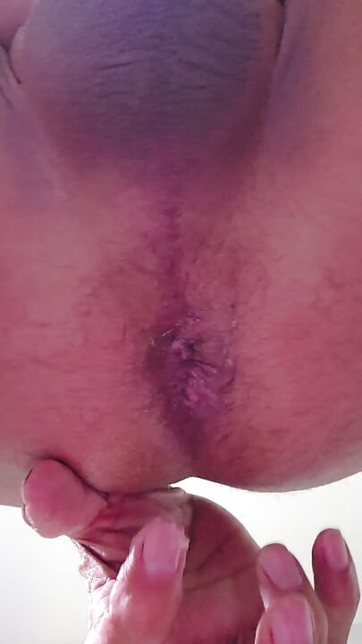 Ladydtf69's cuckold husband stretches his dirty asshole with anal dilator.