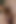 Your POV - Extra Close Views of Big Dick and Full Balls Being Treated