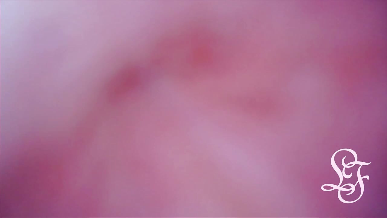 Bulge INSIDE my Bladder from Anal