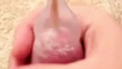 Ses takılı ve prezervatif ile üretral sondaj