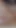 Masaj dölleme