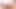 Trans Cock Erection 180