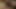 Micro penis cum