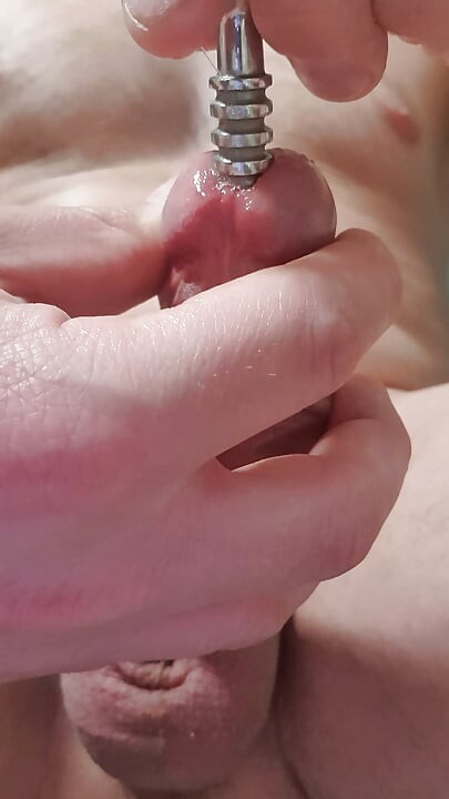 Extremely stretched hole after dilator play