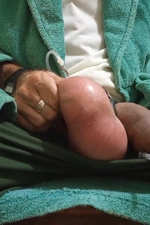 Saline di testis