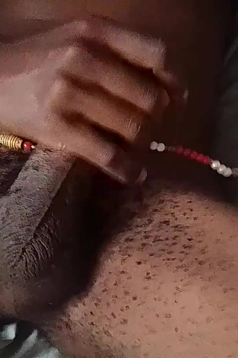 Hairy Balls
