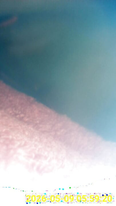 Close up of buttplug & HD Endoscope insertion