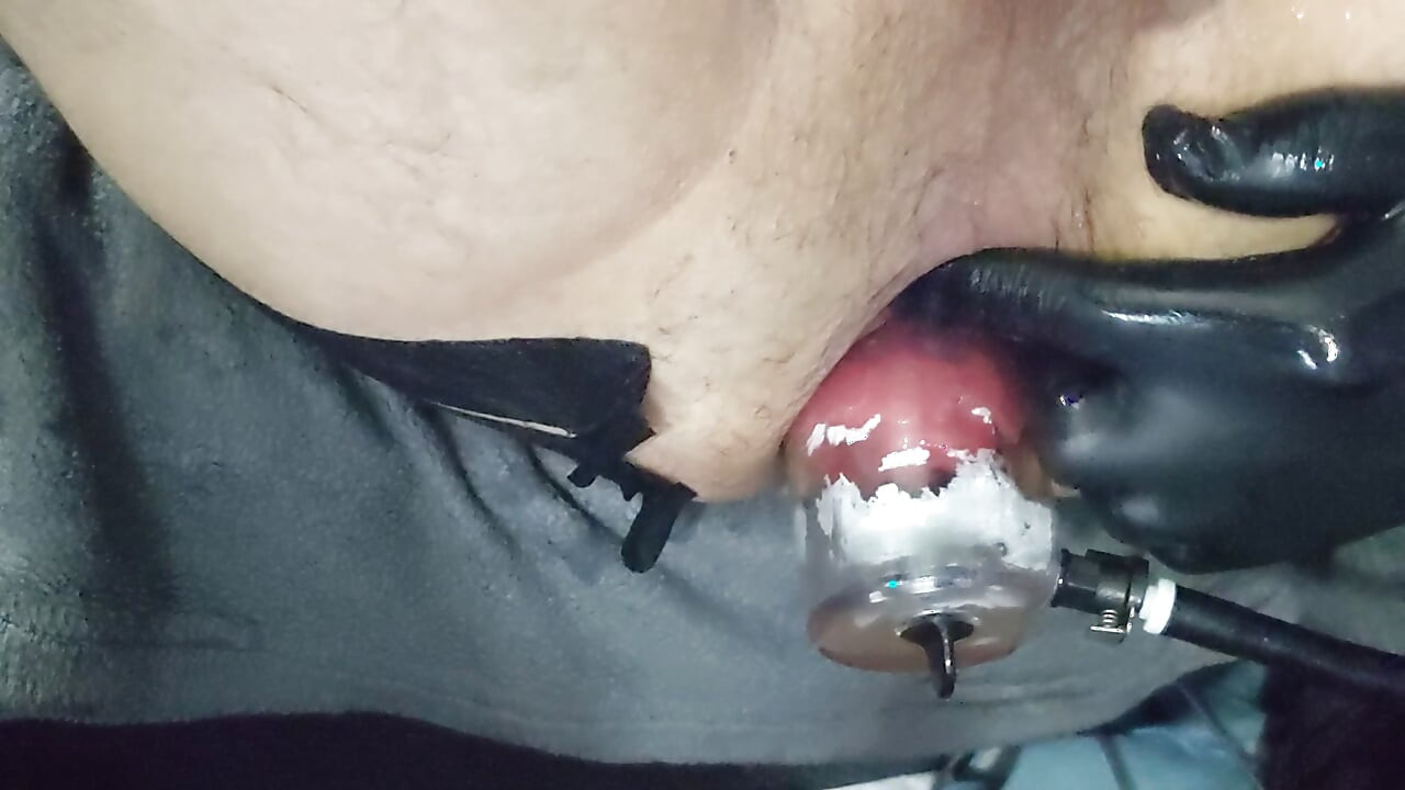 Huge egg play and prolapse pump