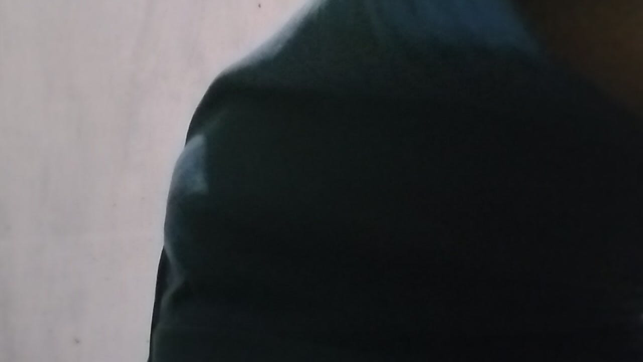 Stvar u guzici