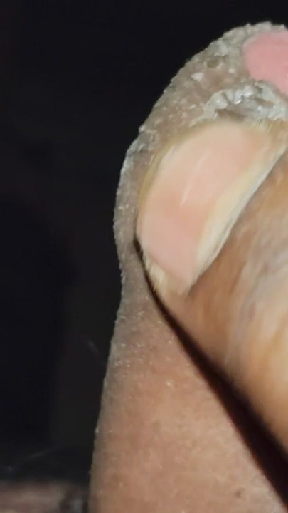 Malai nikali | Clip 1