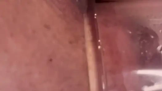 Aşırı anal vakum pompası eğitimi 2025