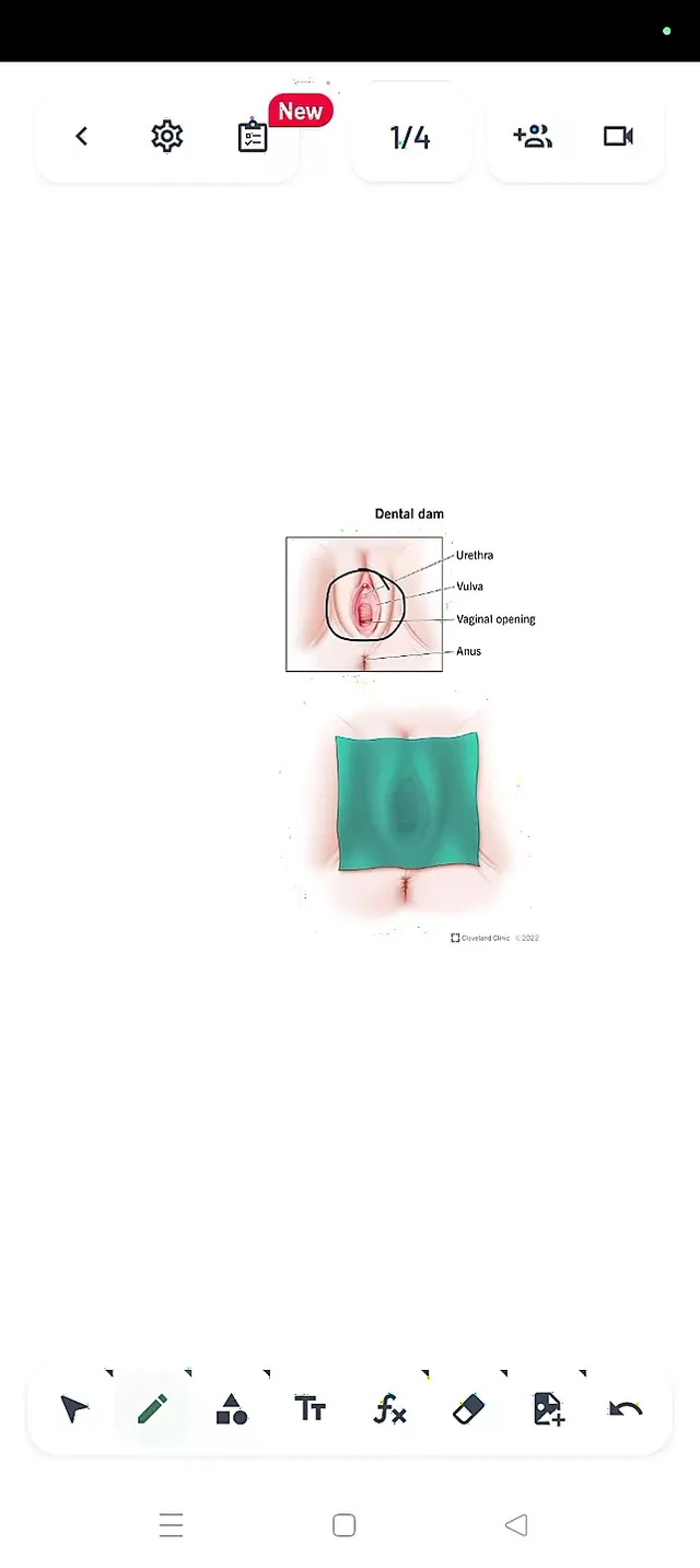 How to Use a Dental Dam